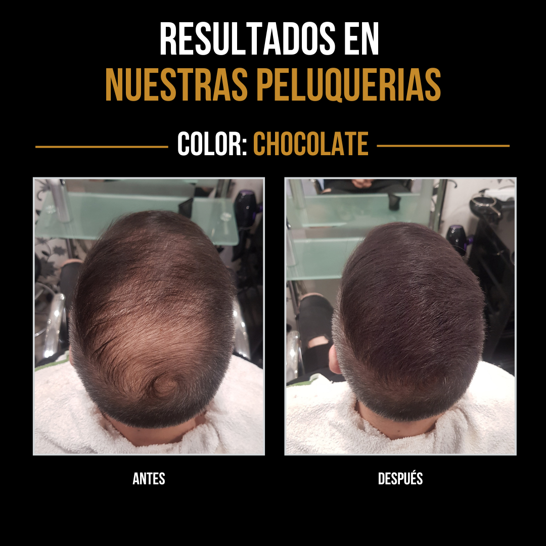 Densificador Capilar
