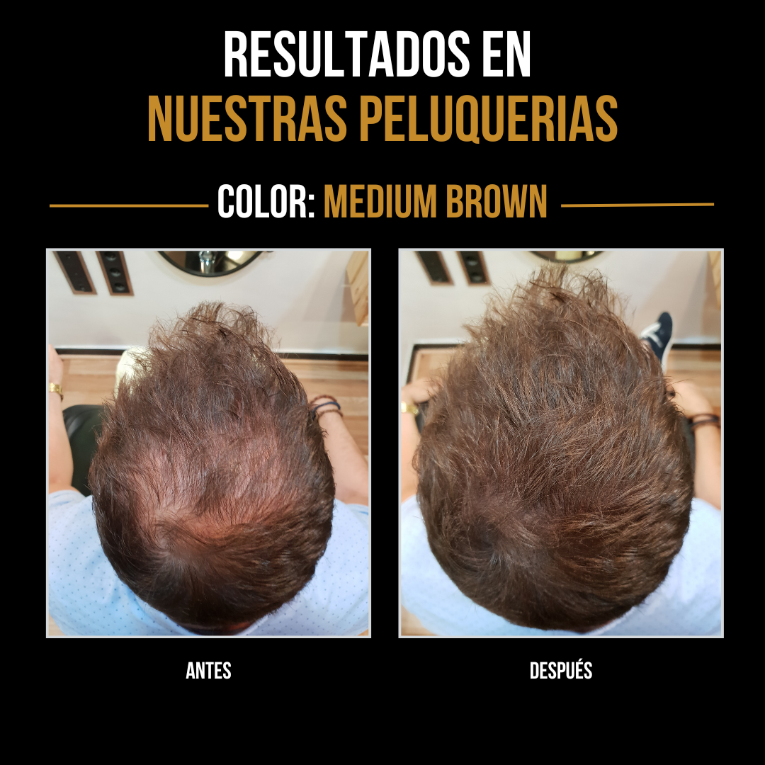 Densificador Capilar